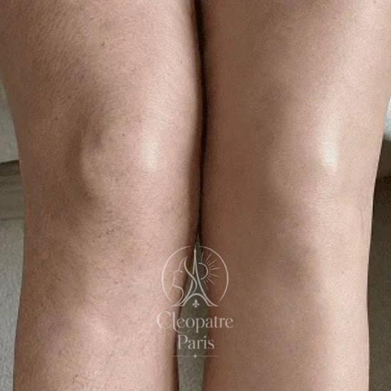 Jambes